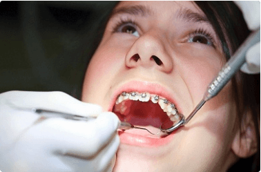 Getting Your Braces On!