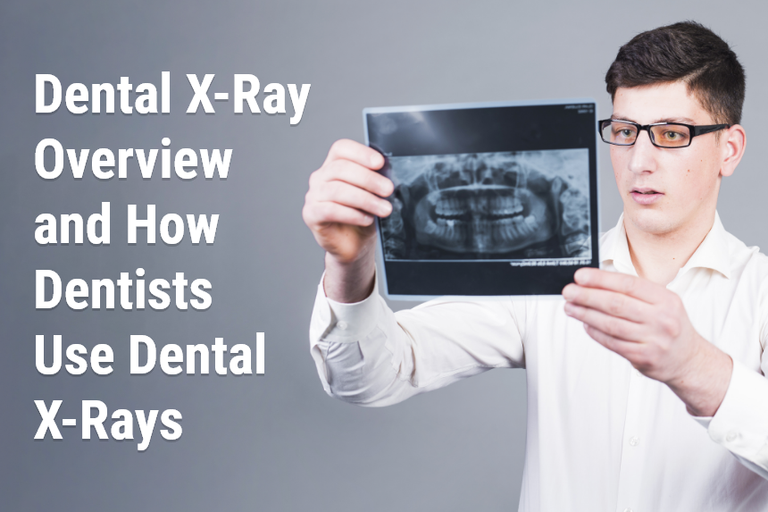 Dental X - Ray - Alpha Dental Clinic 