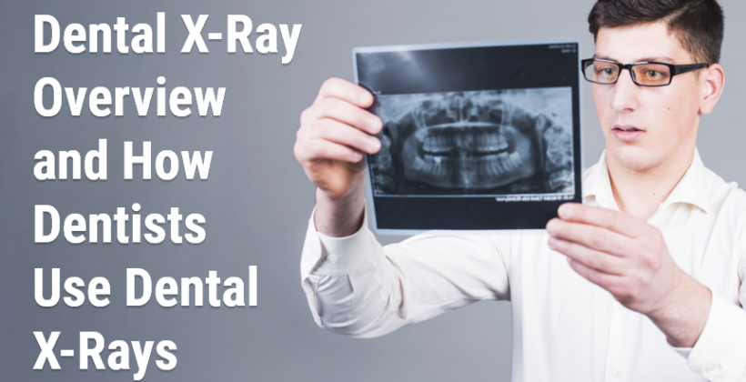 Dental X-Ray Overview and How Dentists Use Dental X-Rays