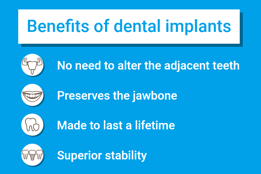 Benefits of dental implants