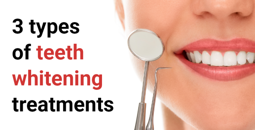 3 types of teeth whitening treatments