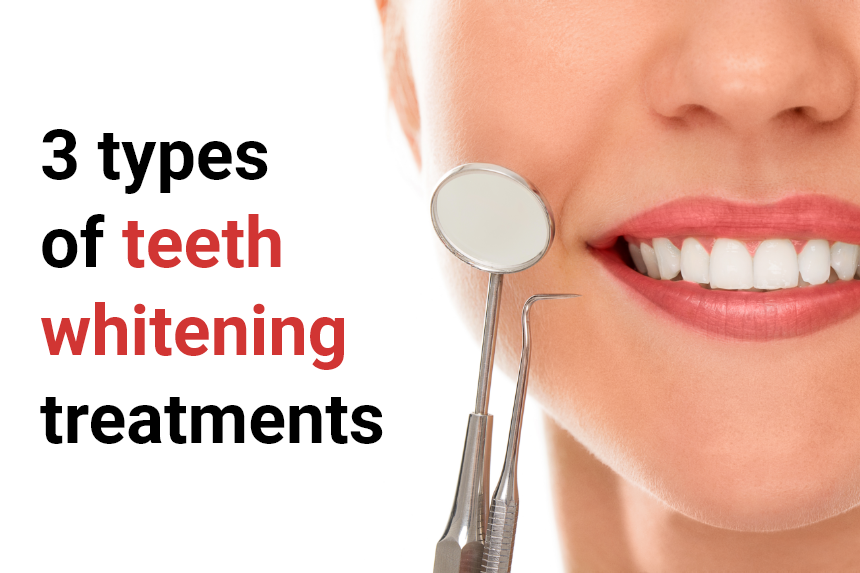 3 types of teeth whitening treatments