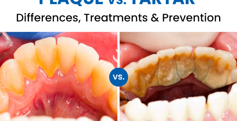 Plaque vs. Tartar: Differences, Treatments & Prevention