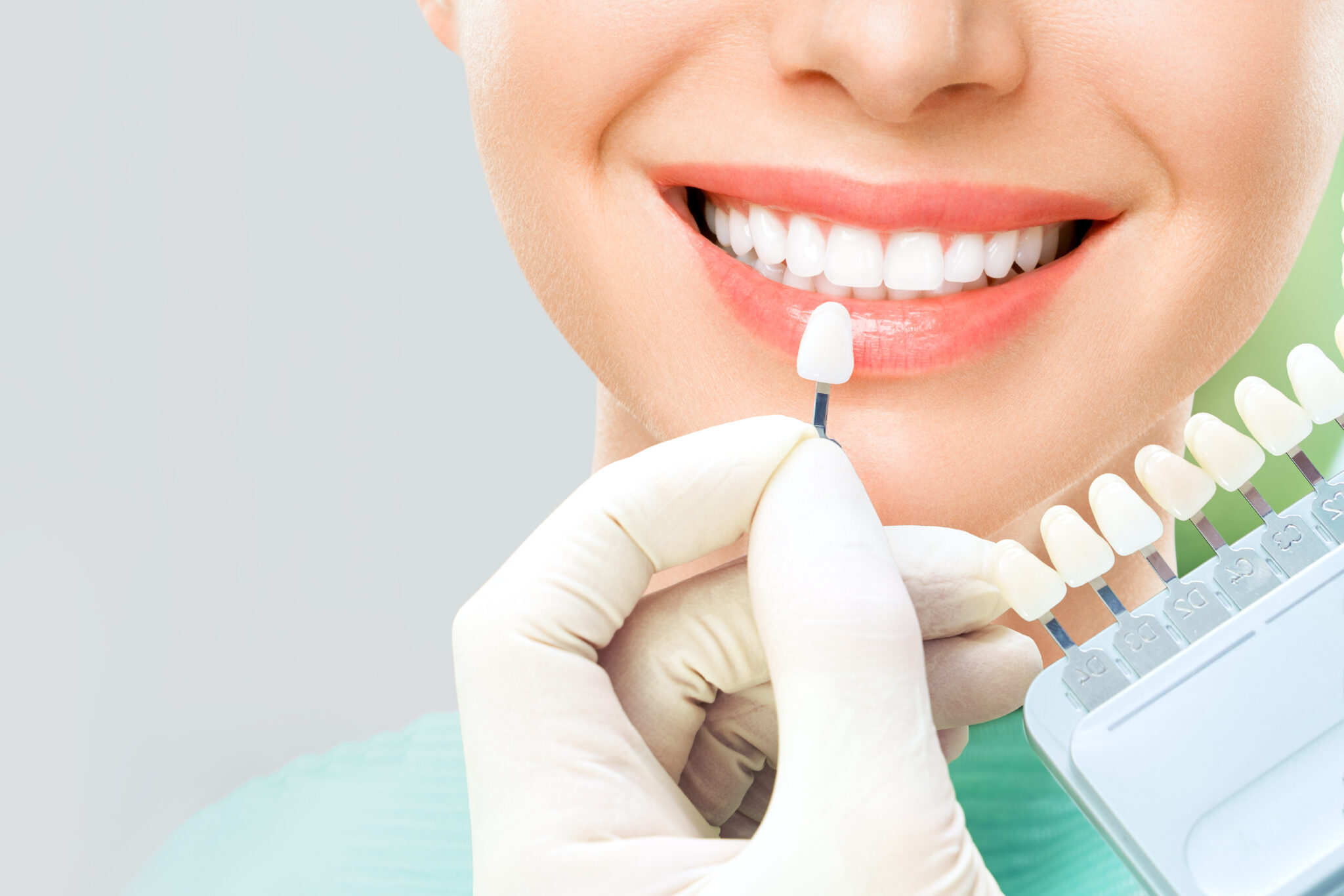 Is Teeth Whitening right for you? Find out at Alpha Dental Clinic