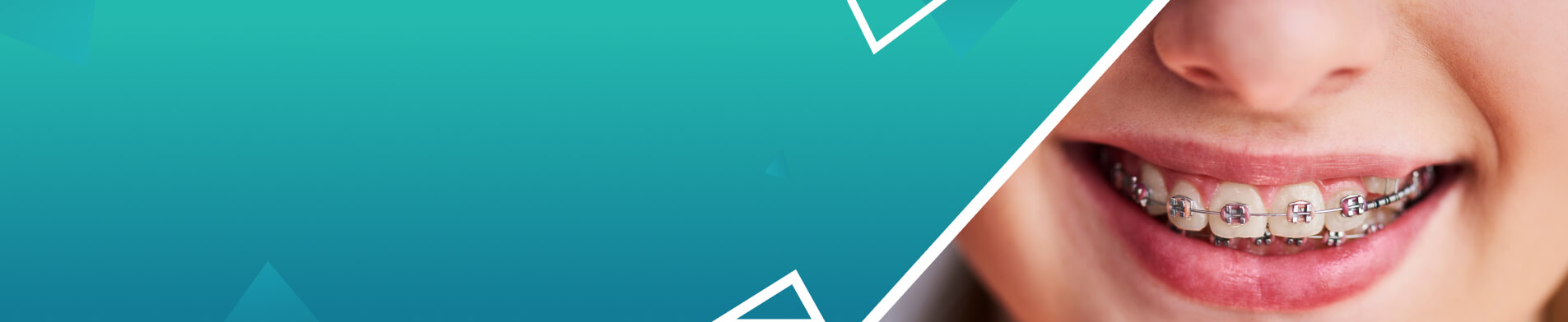 Orthodontic Services