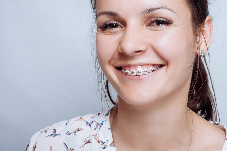 Are Braces Effective for Treating a Gummy Smile?
